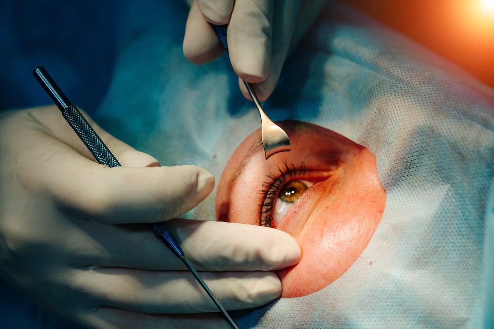 What to Expect During Your LASIK Istanbul Trip