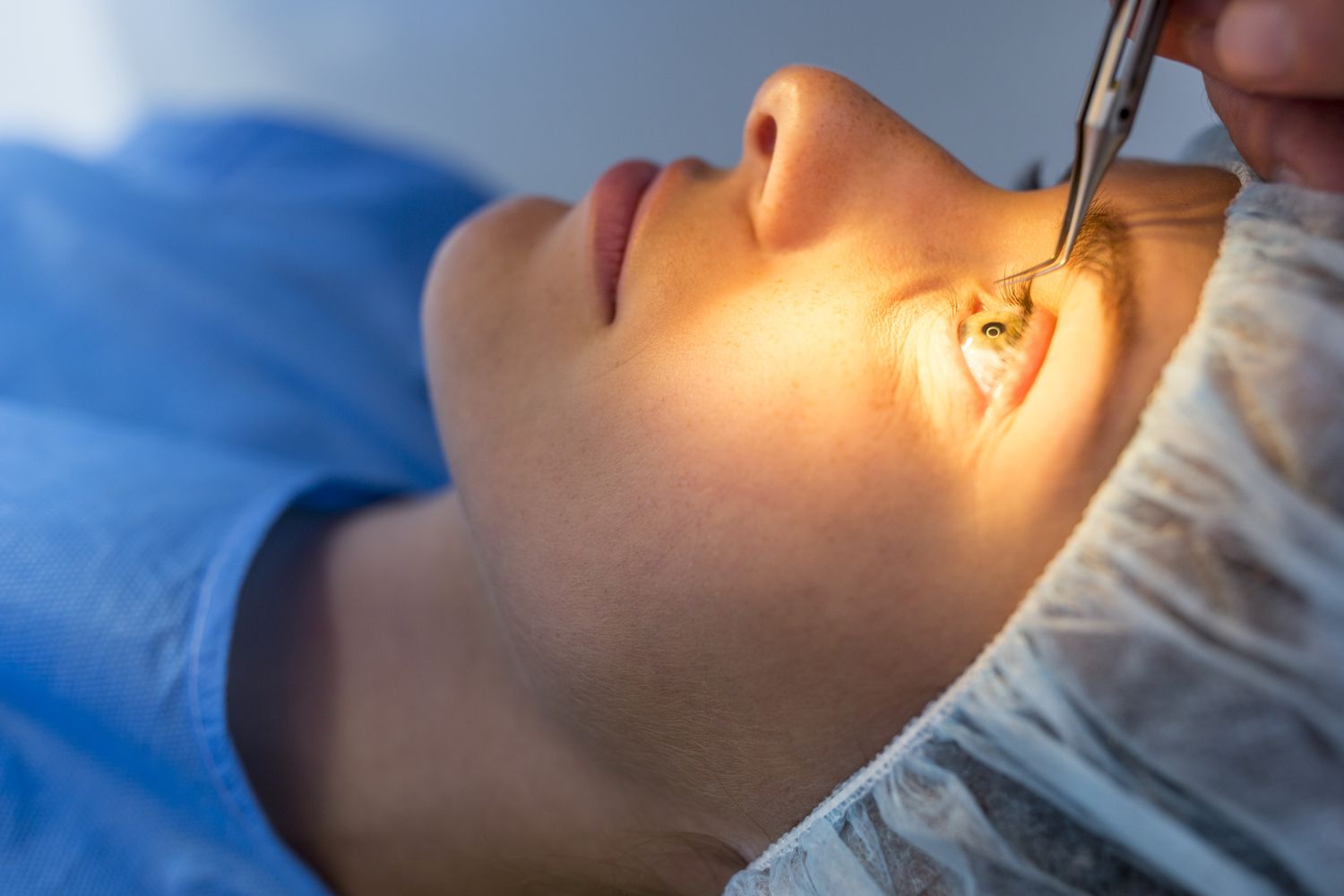 Understanding the Factors Influencing LASIK Turkey Price for Your Procedure